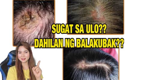 sugat sa ulo in english